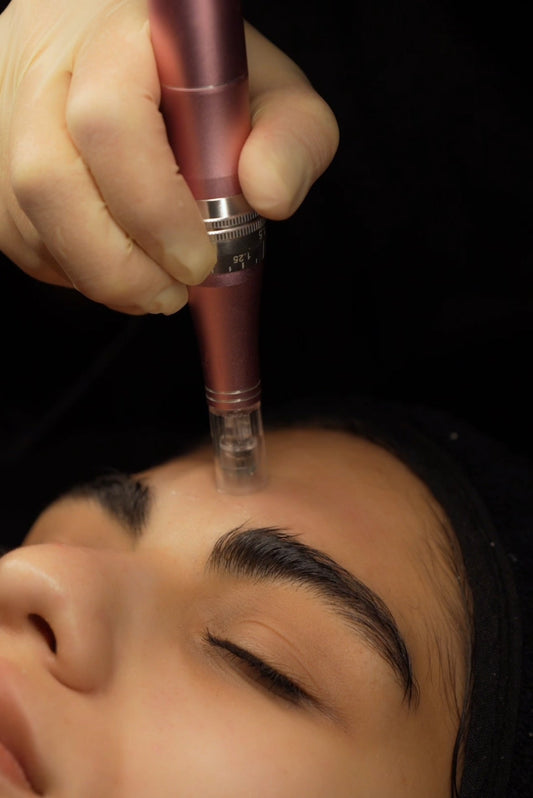 MICRONEEDLING